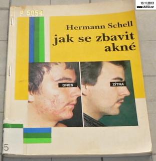 JAK SE ZBAVIT AKNÉ